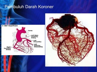 Pembuluh Darah Koroner
 