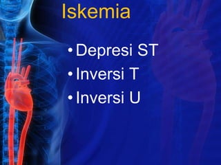 Iskemia
•Depresi ST
•Inversi T
•Inversi U
 