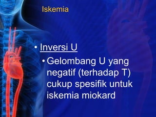 Iskemia
• Inversi U
• Gelombang U yang
negatif (terhadap T)
cukup spesifik untuk
iskemia miokard
 