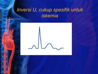 Inversi U, cukup spesifik untuk
iskemia
 