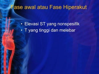 Fase awal atau Fase Hiperakut
• Elevasi ST yang nonspesifik
• T yang tinggi dan melebar
 