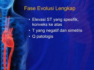 Fase Evolusi Lengkap
• Elevasi ST yang spesifik,
konveks ke atas
• T yang negatif dan simetris
• Q patologis
 