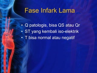 Fase Infark Lama
• Q patologis, bisa QS atau Qr
• ST yang kembali iso-elektrik
• T bisa normal atau negatif
 