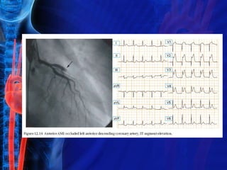 ACS IDI LOTENG - Simposium.ppt