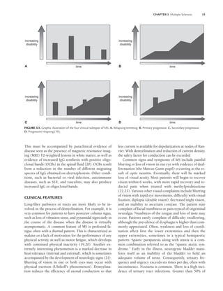 CHAPTER 3 Multiple Sclerosis 35
This must be accompanied by paraclinical evidence of
disease seen as the presence of magnetic resonance imag-
ing (MRI) T2-weighted lesions in white matter, as well as
evidence of increased IgG synthesis with positive oligo-
clonal bands (OCBs) in the spinal fluid (20). OCBs result
from a reduction in the number of different migrating
species of IgG obtained on electrophoresis. Other condi-
tions, such as bacterial or viral infection, autoimmune
diseases, such as SLE, and vasculitis, may also produce
increased IgG or oligoclonal bands.
CLINICAL FEATURES
Long-fiber pathways or tracts are more likely to be in-
volved in the process of demyelination. For example, it is
very common for patients to have posterior column signs,
such as loss of vibration sense, and pyramidal signs early in
the course of the disease when the disease is virtually
asymptomatic. A common feature of MS is profound fa-
tigue often with a diurnal pattern. This is characterized as
malaise or a lack of motivation for the performance of any
physical activity, as well as motor fatigue, which develops
with continued physical inactivity (19,20). Another ex-
tremely interesting phenomenon is a marked decrease in
heat tolerance (internal and external), which is sometimes
accompanied by the development of neurologic signs (21).
Blurring of vision in one or both eyes may occur with
physical exertion (Uhthoff’s phenomenon). Demyelina-
tion reduces the efficiency of axonal conduction so that
less current is available for depolarization at nodes of Ran-
vier. With demyelination and reduction of current density,
the safety factor for conduction can be exceeded
Common signs and symptoms of MS include painful
blurring or loss of vision in one eye with evidence of deaf-
ferentation (the Marcus-Gunn pupil) occurring as the re-
sult of optic neuritis. Eventually, there will be marked
loss of visual acuity. Most patients will begin to recover
vision within 6 weeks, with more rapid recovery and re-
duced pain when treated with methylprednisolone
(22,23). Various other visual complaints include blurring
of vision with rapid eye movements, difficulty with visual
fixation, diplopia (double vision), decreased night vision,
and an inability to ascertain contrast. The patient may
complain of facial numbness or pain typical of trigeminal
neuralgia. Numbness of the tongue and loss of taste may
occur. Patients rarely complain of difficulty swallowing,
although the prevalence of dysphagia is higher than com-
monly appreciated. Often, weakness and loss of coordi-
nation affect first the lower extremities and then the
upper extremities, sometimes in a typical hemiparetic
pattern. Spastic paraparesis along with ataxia is a com-
mon combination referred to as the “spastic ataxic syn-
drome.” Early in the illness, neurogenic bladder mani-
fests itself as an inability of the bladder to hold an
adequate volume of urine. Consequently, urinary fre-
quency and urgency exceeds six times per day, often with
incontinence. Nocturia is common. There is a high inci-
dence of urinary tract infections. Greater than 50% of
time
increasing
disability
time
increasing
disability
time
increasing
disability
time
increasing
disability
A B
C D
FIGURE 3.1. Graphic illustration of the four clinical subtypes of MS. A. Relapsing-remitting. B. Primary progressive. C. Secondary progressive.
D. Progressive relapsing (10).
LWBK191-4034G-C03_34-43.qxd 06/11/2008 10:00 AM Page 35
 