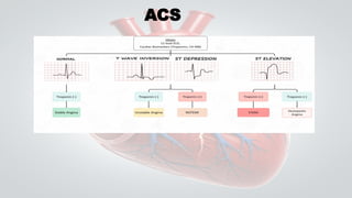acute coronary syndrome management for nurses | PPTX