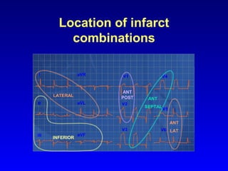 Acute coronary syndromes in Indian context | PPT