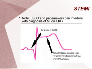 Acute Coronary Syndrome presentation.ppt