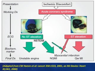 (Adapted from CW Hamm et al: Lancet 358:1533, 2001, an MJ Davies: Heart
83:361, 2000)
 