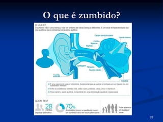 O que é zumbido?
28
 
