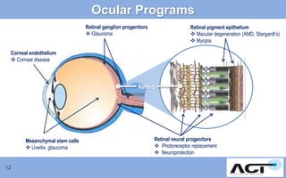 Ocular Programs
Retinal ganglion progenitors
 Glaucoma

Retinal pigment epithelium
 Macular degeneration (AMD, Stargardt’s)
 Myopia

Corneal endothelium
 Corneal disease

light
Retina

Mesenchymal stem cells
 Uveitis, glaucoma
12

Retinal neural progenitors
 Photoreceptor replacement
 Neuroprotection

 