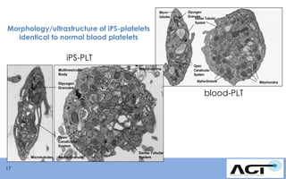 Microtubules

Morphology/ultrastructure of iPS-platelets
identical to normal blood platelets

Glycogen
Granules
Dense Tubular
System

iPS-PLT
Multivesicular
Body

Mitochondria

Alpha-Granule

Glycogen
Granules

blood-PLT

Open
Canalicular
System
Microtubules

17

Alpha-Granule

Open
Canalicular
System

Dense Tubular
System

Mitochondria

 