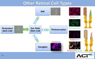 Other Retinal Cell Types
RNP
PDE6a/DAPI

Pluripotent
Stem Cell

Eye Field
Stem Cell

Photoreceptor

Opsin (green/red)

PDE6a/DAPI
Math5/DAPI

Ganglion
Rhodopsin/Recoverin
21

 