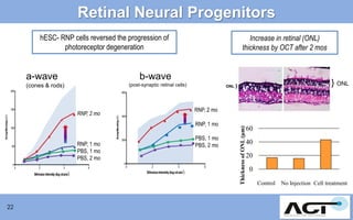 Retinal Neural Progenitors
hESC- RNP cells reversed the progression of
photoreceptor degeneration

b-wave
(post-synaptic retinal cells)

(cones & rods)

RNP, 2 mo

ONL

RNP, 2 mo
RNP, 1 mo

RNP, 1 mo
PBS, 1 mo
PBS, 2 mo

22

} ONL

}

PBS, 1 mo
PBS, 2 mo

Thickness of ONL (µm)

a-wave

Increase in retinal (ONL)
thickness by OCT after 2 mos

60
40
20
0
Control

No Injection Cell treatment

 