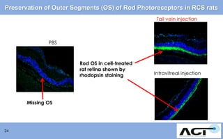 Preservation of Outer Segments (OS) of Rod Photoreceptors in RCS rats
Tail vein injection

PBS

Rod OS in cell-treated
rat retina shown by
rhodopsin staining

Missing OS

24

Intravitreal injection

 
