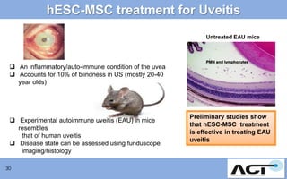hESC-MSC treatment for Uveitis
Untreated EAU mice

 An inflammatory/auto-immune condition of the uvea
 Accounts for 10% of blindness in US (mostly 20-40
year olds)

 Experimental autoimmune uveitis (EAU) in mice
resembles
that of human uveitis
 Disease state can be assessed using funduscope
imaging/histology
30

PMN and lymphocytes

Preliminary studies show
that hESC-MSC treatment
is effective in treating EAU
uveitis

 