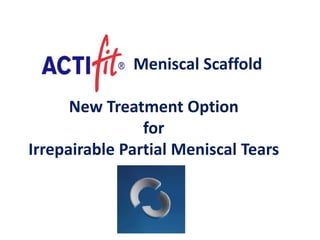 - Meniscal Scaffold
New Treatment Option
for
Irrepairable Partial Meniscal Tears
 