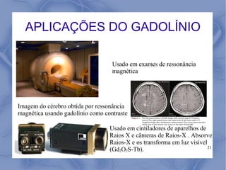 APLICAÇÕES DO GADOLÍNIO

                                   Usado em exames de ressonância
                                   magnética




Imagem do cérebro obtida por ressonância
magnética usando gadolínio como contraste

                                  Usado em cintiladores de aparelhos de
                                  Raios X e câmeras de Raios-X . Absorve
                                  Raios-X e os transforma em luz visível
                                                                         21
                                  (Gd2O2S-Tb).
 