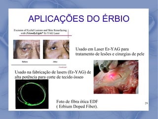 APLICAÇÕES DO ÉRBIO


                                Usado em Laser Er-YAG para
                                tratamento de lesões e cirurgias de pele



Usado na fabricação de lasers (Er-YAG) de
alta potência para corte de tecido ósseo




                      Foto de fibra ótica EDF                              29
                      ( Erbium Doped Fiber).
 