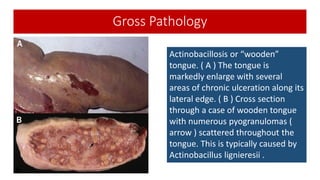 Actinobacilosis (Wooden Tongue) | PDF