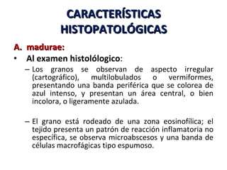 CARACTERÍSTICAS HISTOPATOLÓGICAS madurae: Al examen histolólogico : Los granos se observan de aspecto irregular (cartográfico), multilobulados o vermiformes, presentando una banda periférica que se colorea de azul intenso, y presentan un área central, o bien incolora, o ligeramente azulada.  El grano está rodeado de una zona eosinofílica; el tejido presenta un patrón de reacción inflamatoria no específica, se observa microabscesos y una banda de células macrofágicas tipo espumoso.  