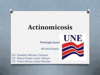 Actinomicosis

                     Patología bucal

                      4B odontología

CD. Oswaldo Méndez Campos
CD. Miguel Ángel López Velasco
CD. Pedro Alonso López Morales
 