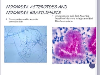 NOCARDIA ASTEROIDES AND
NOCARDIA BRASILIENSIS
 Gram-positive aerobic Nocardia
asteroides slide
 Gram-positive acid-fast Nocardia
brasiliensis bacteria using a modified
Fite-Faraco stain
 
