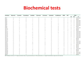 Biochemical tests
 