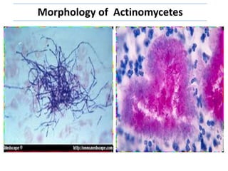 Morphology of Actinomycetes
 