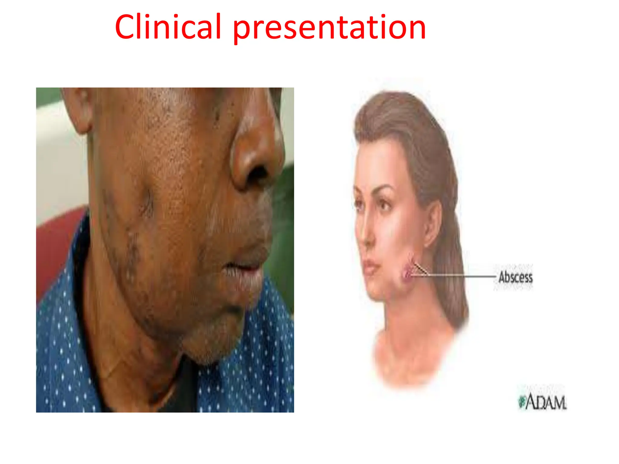 Clinical presentation
 