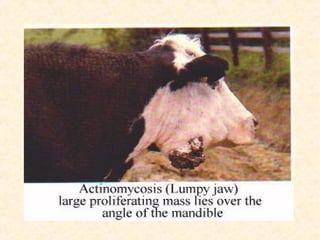 Actinomycosis