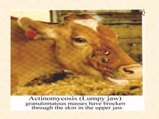 Actinomycosis