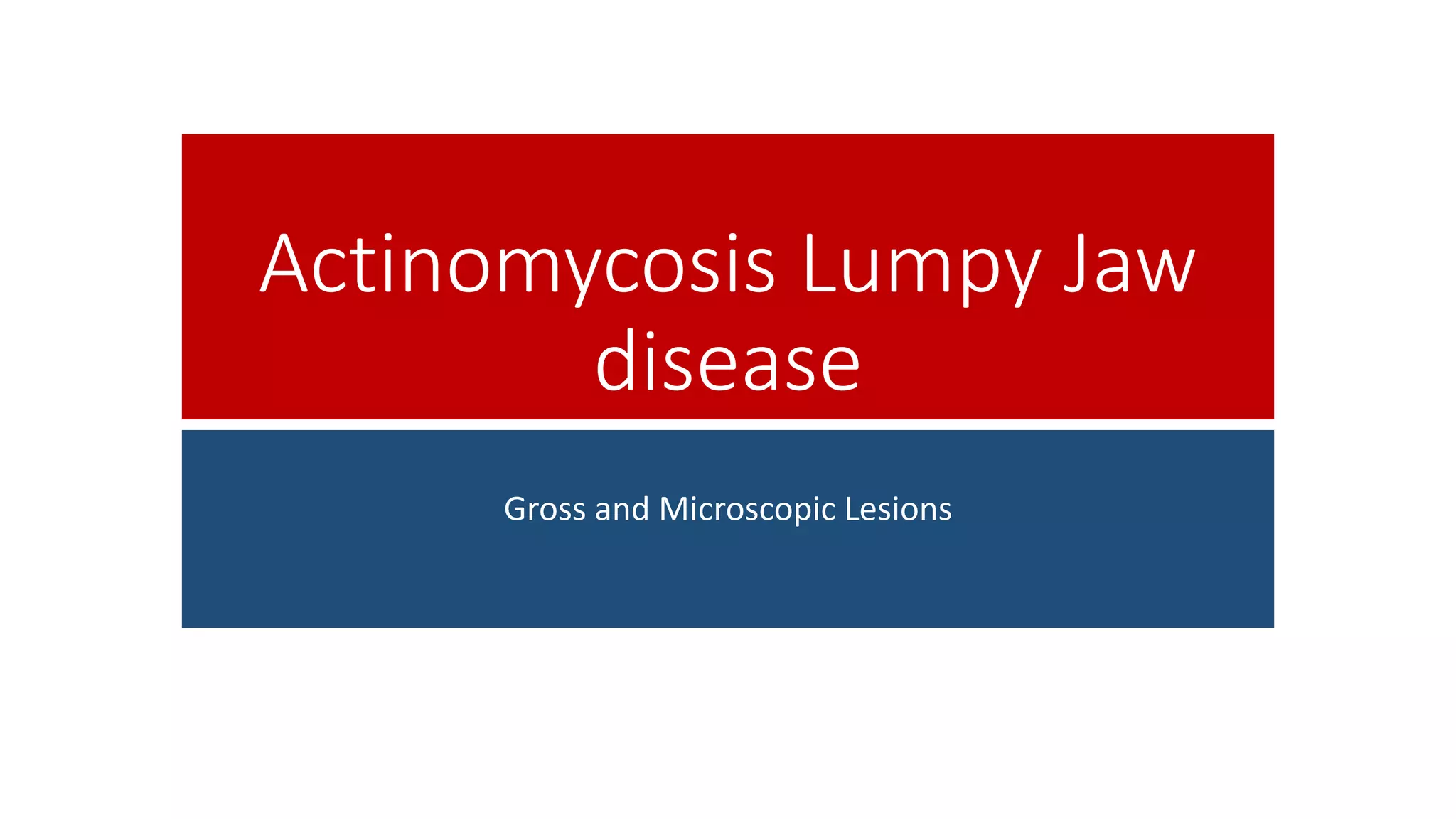 Actinomycosis (Lumpy Jaw) PPT