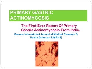 PRIMARY GASTRIC
ACTINOMYCOSIS
The First Ever Report Of Primary
Gastric Actinomycosis From India.
Source: International Journal of Medical Research &
Health Sciences (IJMRHS)
 