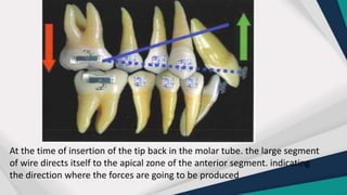 Apical Direction ACTION AND REACTION in orthodontic movements.pptx