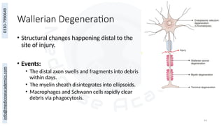 64
Wallerian Degeneration
• Structural changes happening distal to the
site of injury.
• Events:
• The distal axon swells and fragments into debris
within days.
• The myelin sheath disintegrates into ellipsoids.
• Macrophages and Schwann cells rapidly clear
debris via phagocytosis.
 