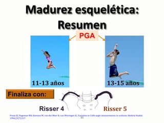 Madurez esquelética:
Resumen
11-13 años 13-15 años
PGA
Risser 4 Risser 5
Finaliza con:
Pruijs JE, Hageman MA, Keessen W, v...