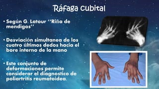 actitudes-patol-gicas-de-la-mano-y-dedos-pptx