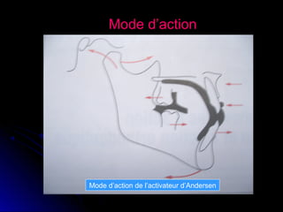 Mode d’action

Mode d’action de l’activateur d’Andersen

 