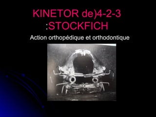 KINETOR de(4-2-3
:STOCKFICH
Action orthopédique et orthodontique

 