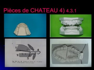 Pièces de CHATEAU 4( 4.3.1

 