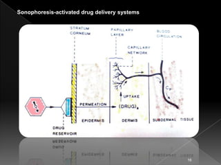 Sonophoresis-activated drug delivery systems




                                               16
 