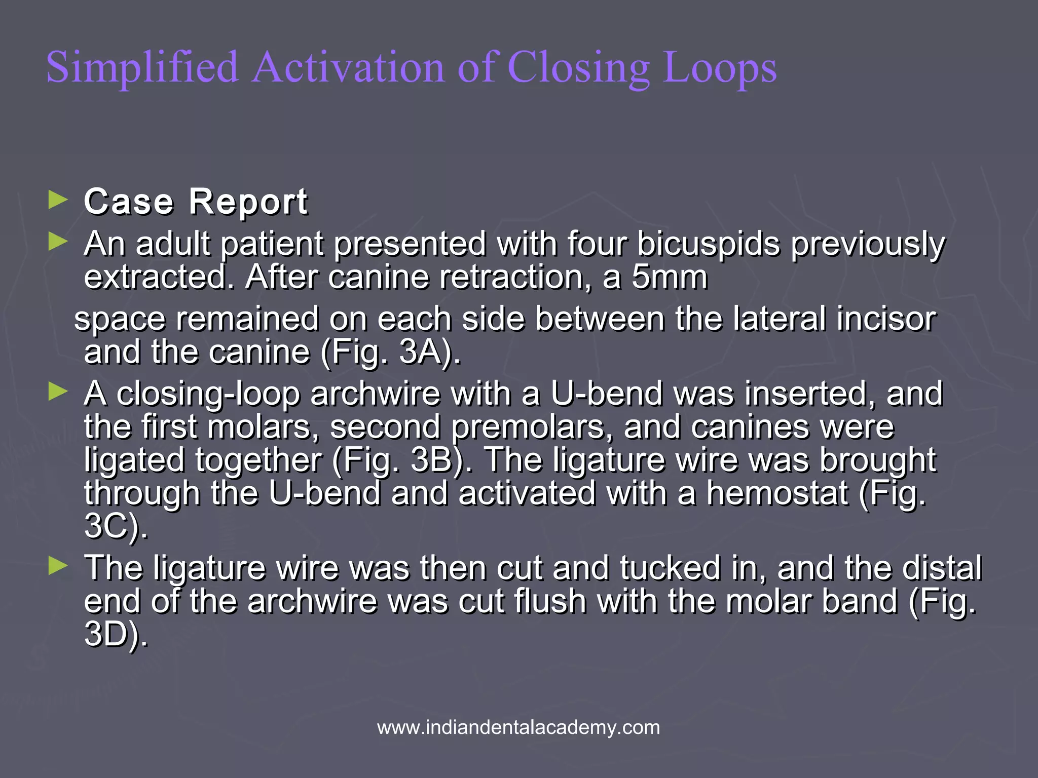 Simplified Activation of Closing Loops
► Case ReportCase Report
► An adult patient presented with four bicuspids previouslyAn adult patient presented with four bicuspids previously
extracted. After canine retraction, a 5mmextracted. After canine retraction, a 5mm
space remained on each side between the lateral incisorspace remained on each side between the lateral incisor
and the canine (Fig. 3A).and the canine (Fig. 3A).
► A closing-loop archwire with a U-bend was inserted, andA closing-loop archwire with a U-bend was inserted, and
the first molars, second premolars, and canines werethe first molars, second premolars, and canines were
ligated together (Fig. 3B). The ligature wire was broughtligated together (Fig. 3B). The ligature wire was brought
through the U-bend and activated with a hemostat (Fig.through the U-bend and activated with a hemostat (Fig.
3C).3C).
► The ligature wire was then cut and tucked in, and the distalThe ligature wire was then cut and tucked in, and the distal
end of the archwire was cut flush with the molar band (Fig.end of the archwire was cut flush with the molar band (Fig.
3D).3D).
www.indiandentalacademy.com
 