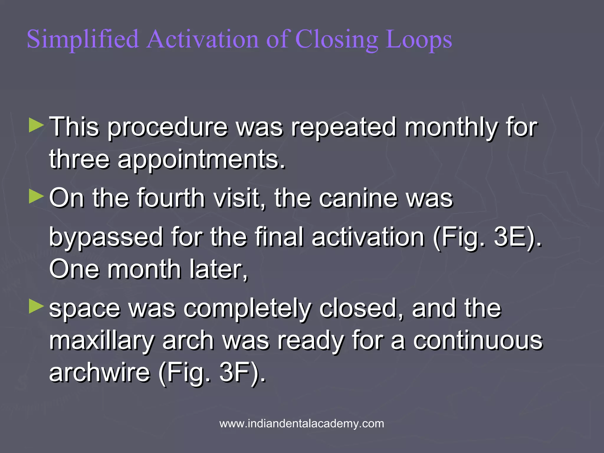 Simplified Activation of Closing Loops
►This procedure was repeated monthly forThis procedure was repeated monthly for
three appointments.three appointments.
►On the fourth visit, the canine wasOn the fourth visit, the canine was
bypassed for the final activation (Fig. 3E).bypassed for the final activation (Fig. 3E).
One month later,One month later,
►space was completely closed, and thespace was completely closed, and the
maxillary arch was ready for a continuousmaxillary arch was ready for a continuous
archwire (Fig. 3F).archwire (Fig. 3F).
www.indiandentalacademy.com
 