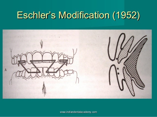 Modifications Of Activator