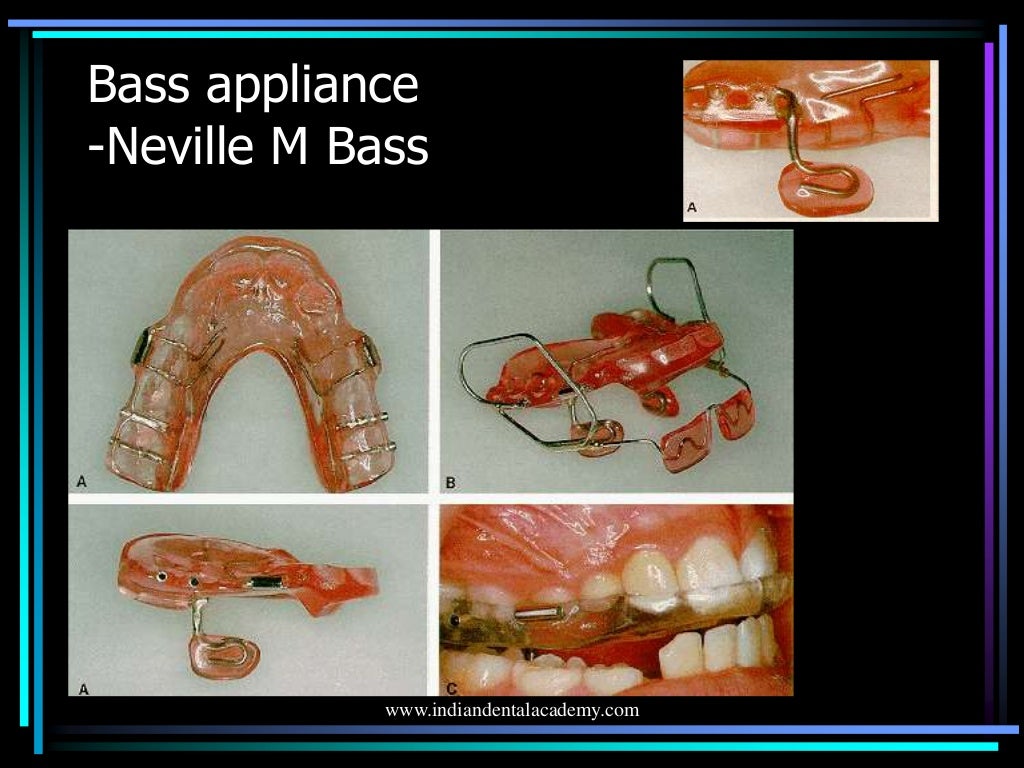 Activator , bionator /certified fixed orthodontic courses by Indian d…
