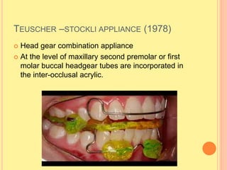 TEUSCHER –STOCKLI APPLIANCE (1978)
 Head gear combination appliance
 At the level of maxillary second premolar or first
molar buccal headgear tubes are incorporated in
the inter-occlusal acrylic.
 