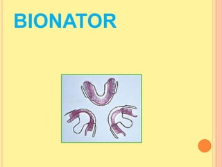 BIONATOR
 