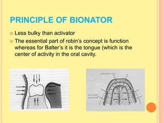 PRINCIPLE OF BIONATOR
 Less bulky than activator
 The essential part of robin’s concept is function
whereas for Balter’s it is the tongue (which is the
center of activity in the oral cavity.
 