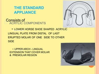 THE STANDARD
APPLIANCE
Consists of
72
ACRYLIC COMPONENTS
- LOWER HORSE SHOE SHAPED ACRYLIC
LINGUAL PLATE FROM DISTAL OF LAST
ERUPTED MOLAR OF ONE SIDE TO OTHER
SIDE
- UPPER ARCH - LINGUAL
EXTENSION THAT COVER MOLAR
& PREMOLAR REGION
 